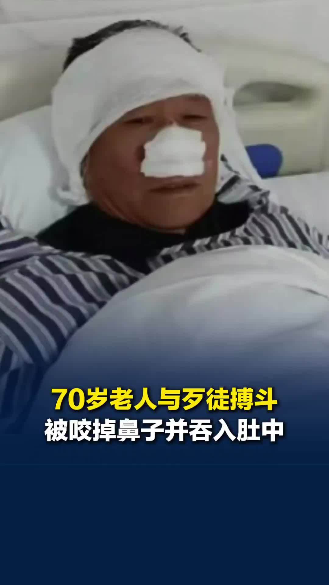 郴州70岁老人与歹徒搏斗被咬掉鼻子并吞入肚中