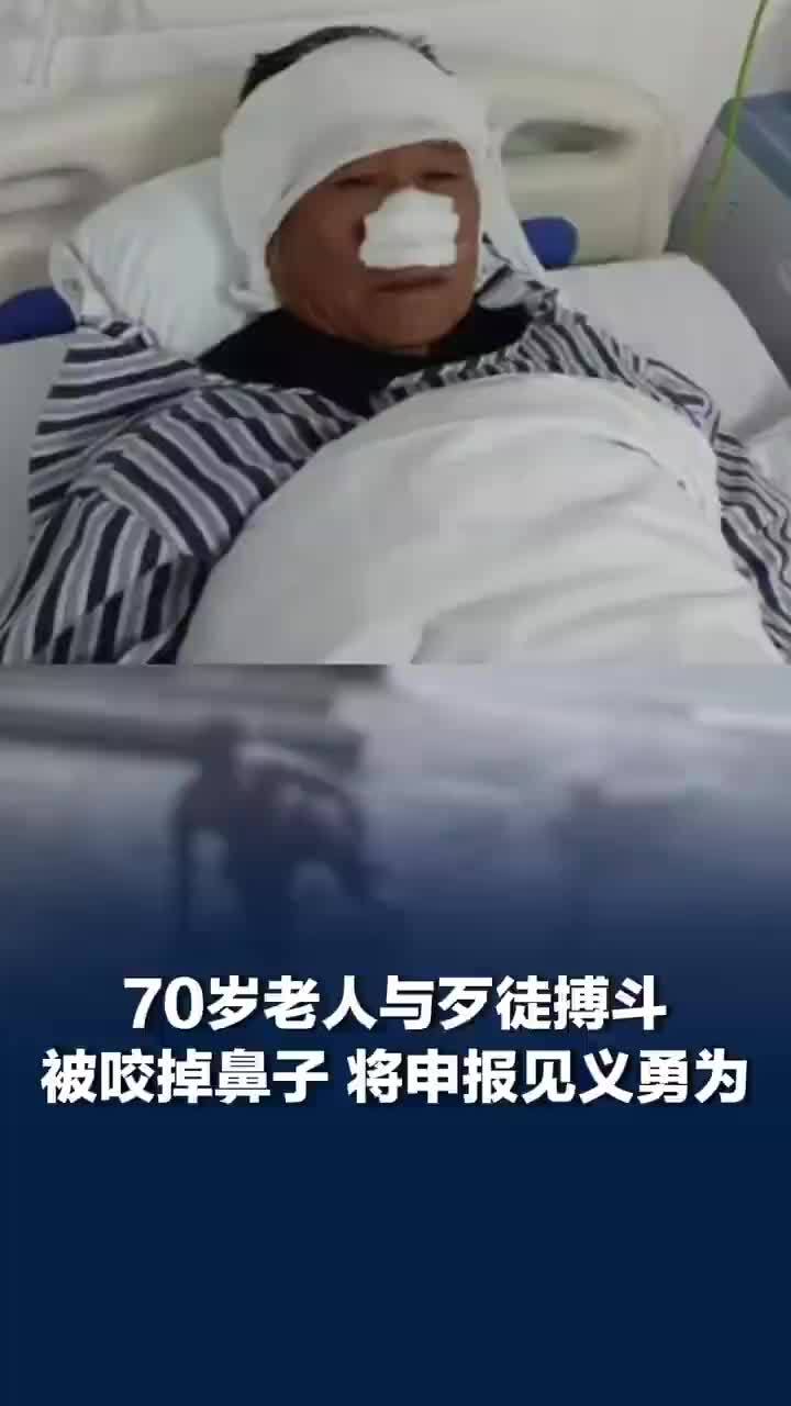 与歹徒搏斗被咬掉鼻子老人发声，老人被歹徒咬掉鼻子医疗费需7万