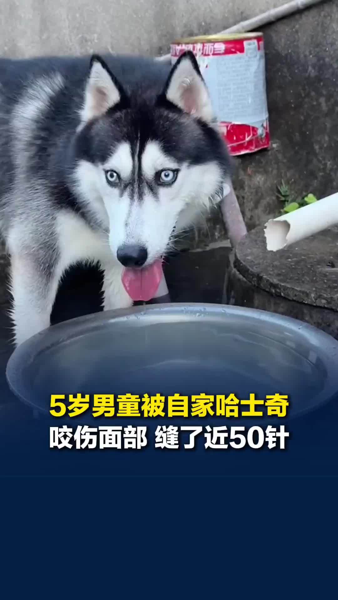 江苏5岁男童被自家养了几年的哈士奇咬伤面部，缝了近50针