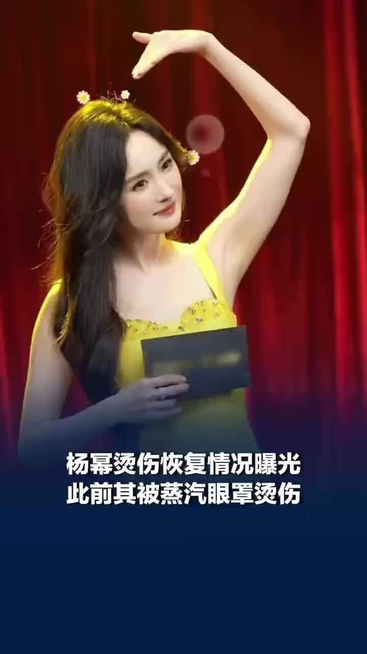 杨幂脸部烫伤还没好，医生称杨幂低温烫伤恢复最少需两周