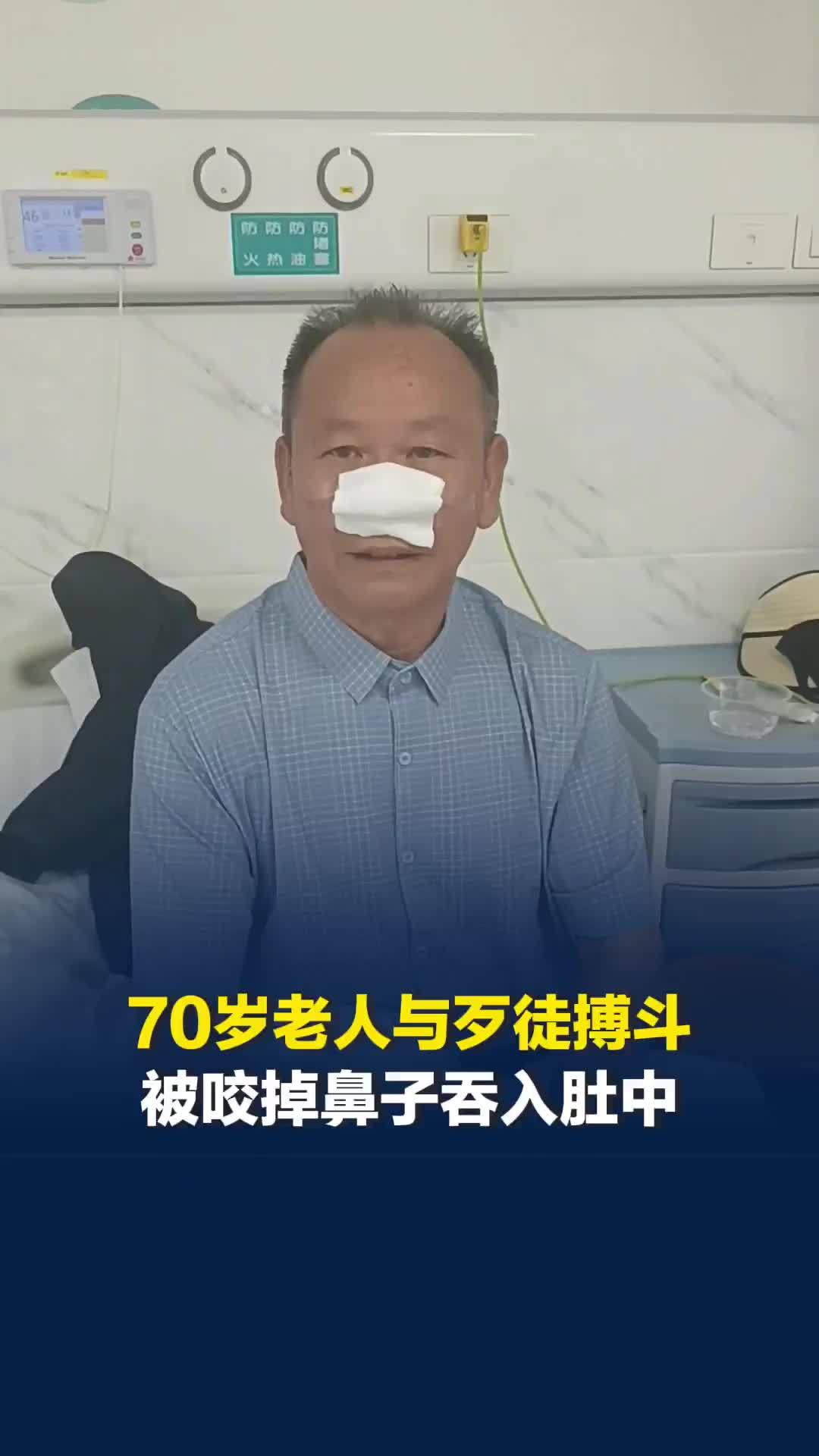 湖南70岁老人与歹徒搏斗被咬掉鼻子：半个月了还有闷痛感，一天仅睡3个小时