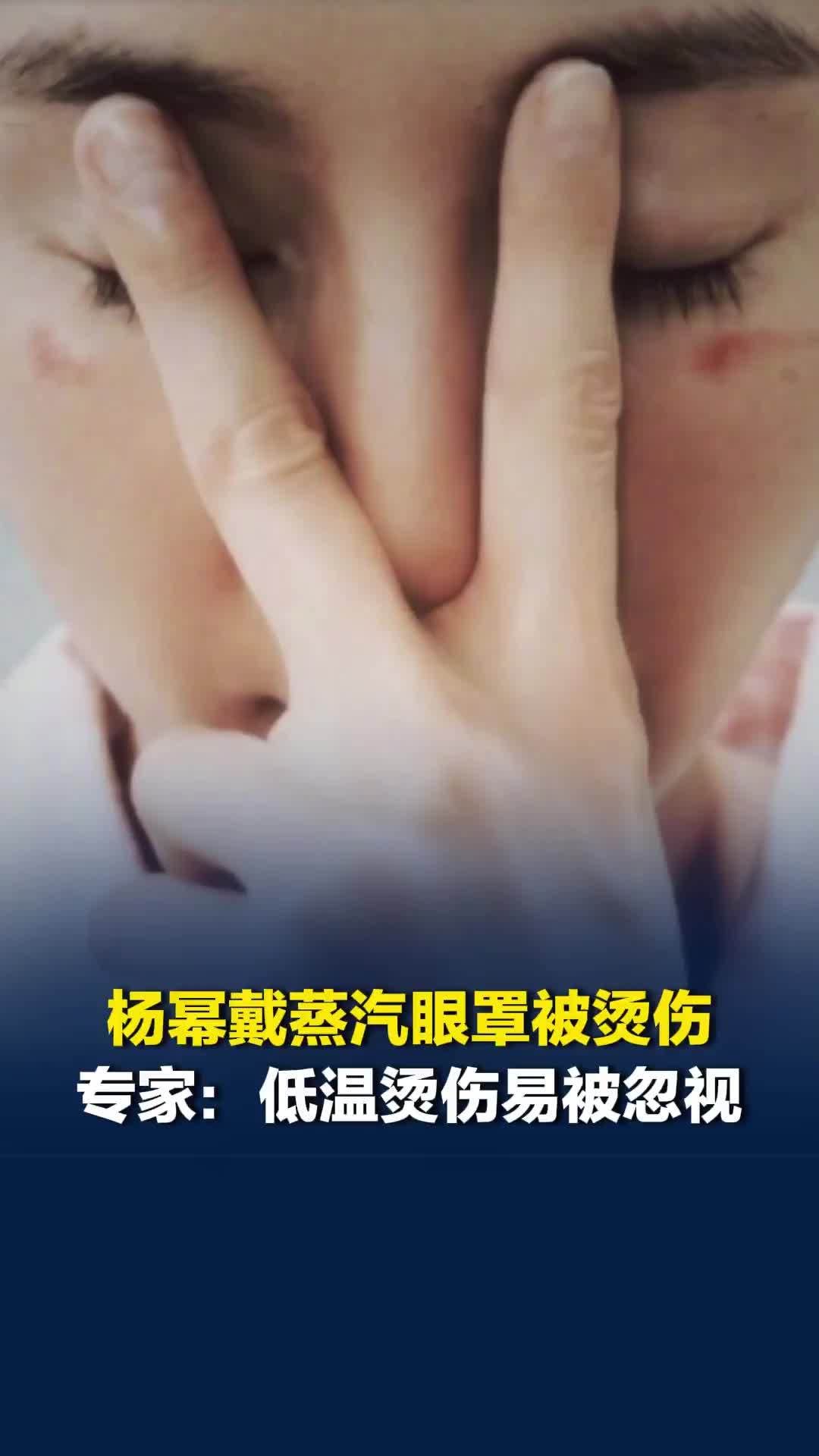 杨幂戴蒸汽眼罩被烫伤；专家：睡眠中更易忽视低温烫伤