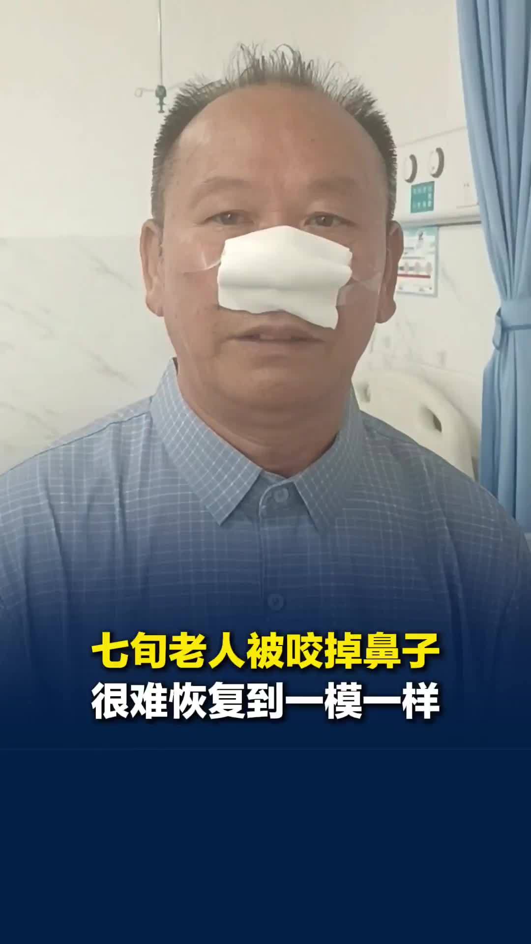 老人被歹徒咬掉的鼻子能恢复吗？主治医师：很难恢复到一模一样