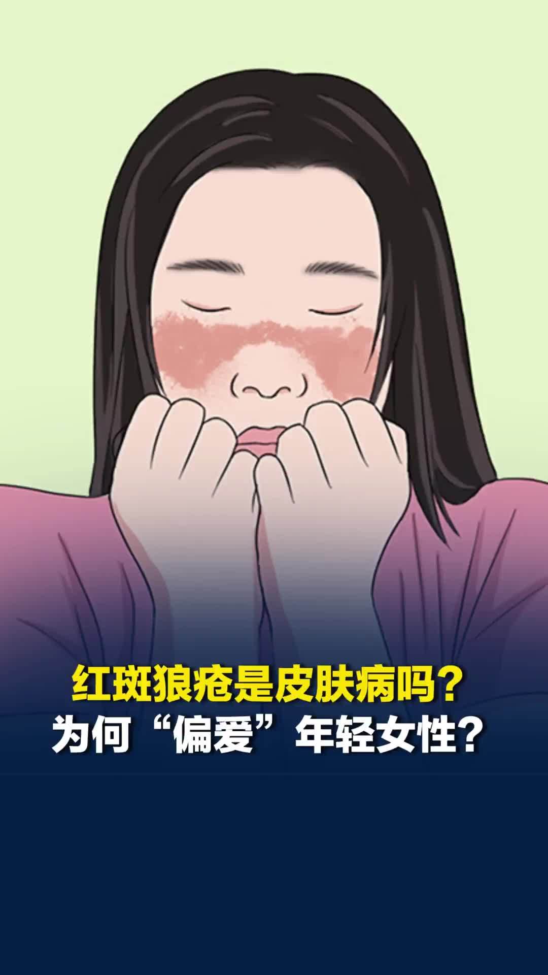 红斑狼疮是皮肤病吗？为何“偏爱”年轻女性？皮肤科专家揭秘真相