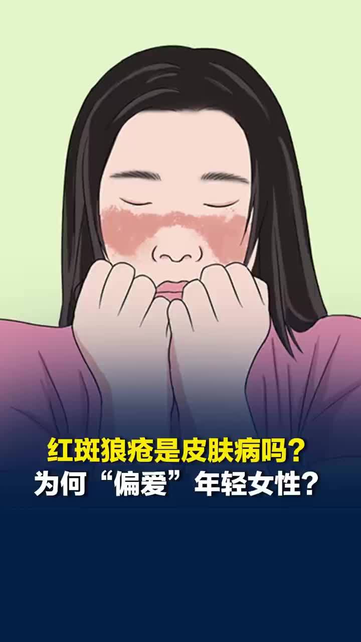 专家谈红斑狼疮为何偏爱年轻女性，红斑狼疮是自身免疫性疾病