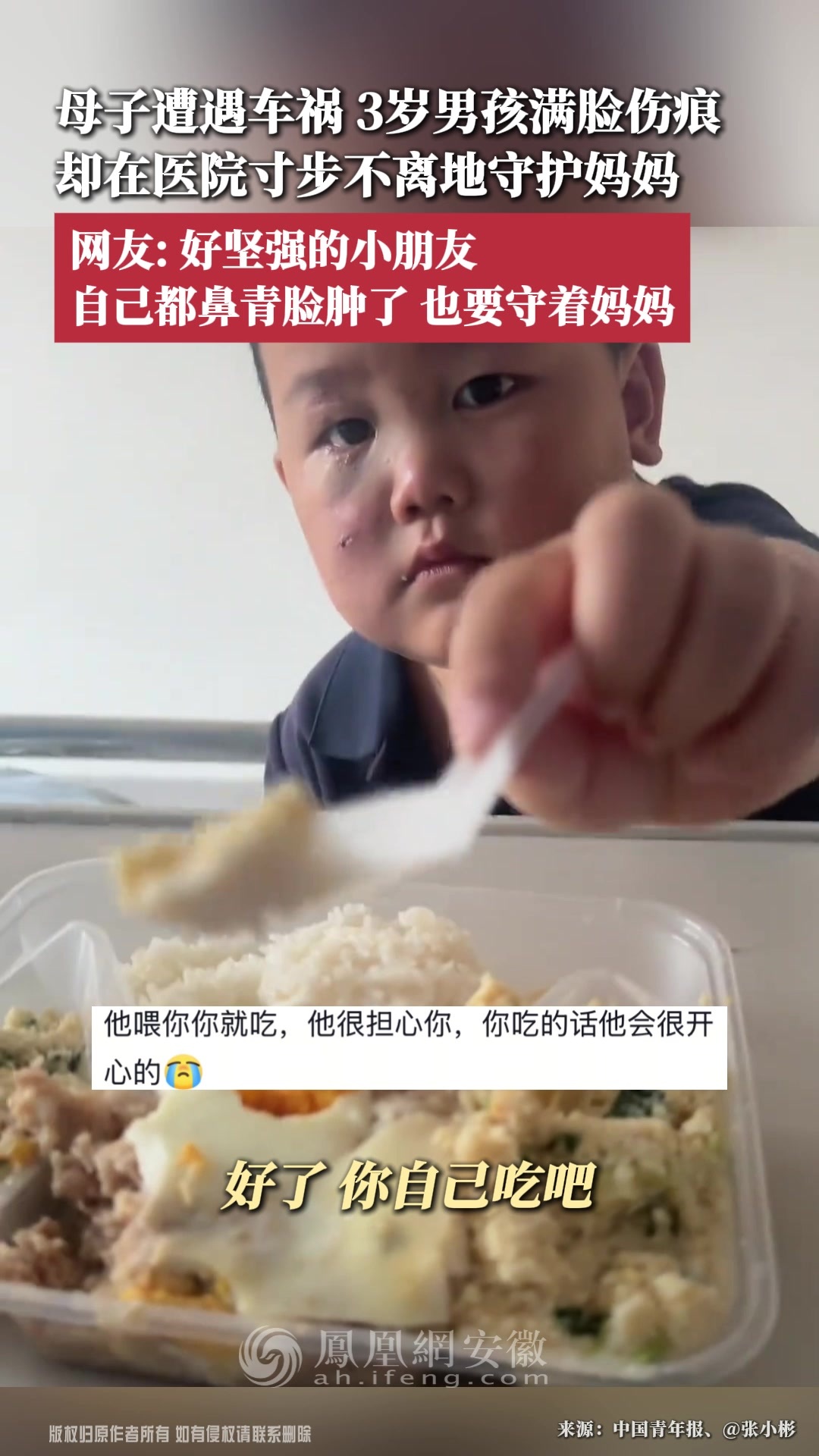 母子遭遇车祸，3岁男孩满脸伤痕，却在医院寸步不离地守护妈妈；网友：好坚强的小朋友