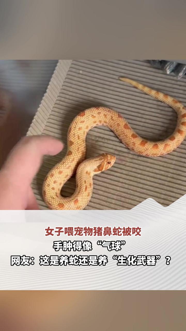 女子喂宠物猪鼻蛇被咬 手肿得像“气球”网友：这是养蛇还是养“生化武器”？
