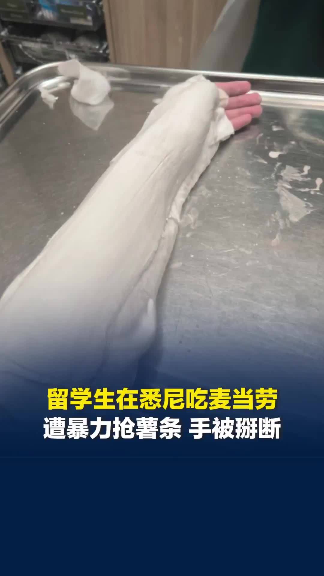 中国留学生在悉尼吃麦当劳，遭流浪汉抢夺薯条，手被掰断