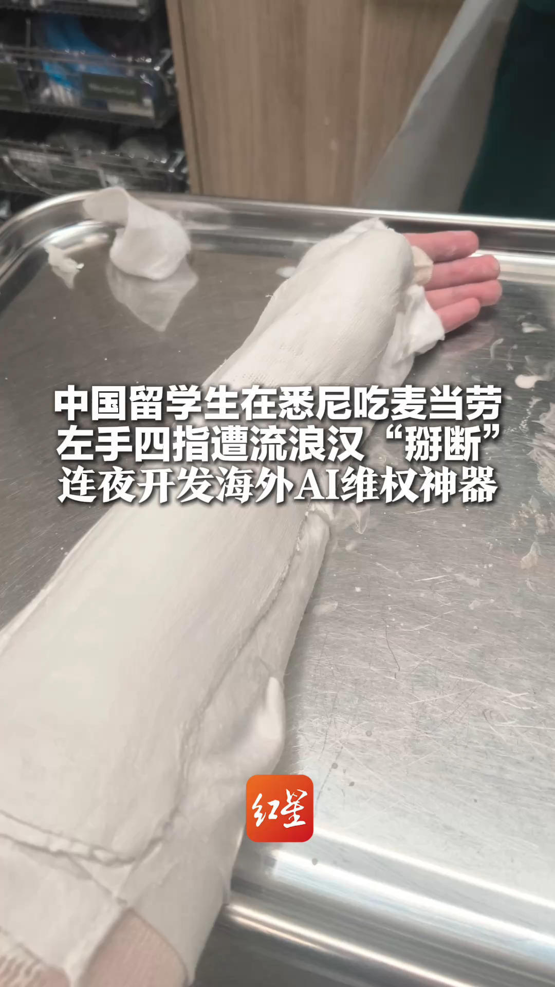 中国留学生在悉尼吃麦当劳 左手四指遭流浪汉“掰断”当事人：当场嘎嘣一声 连夜开发海外AI维权神器
