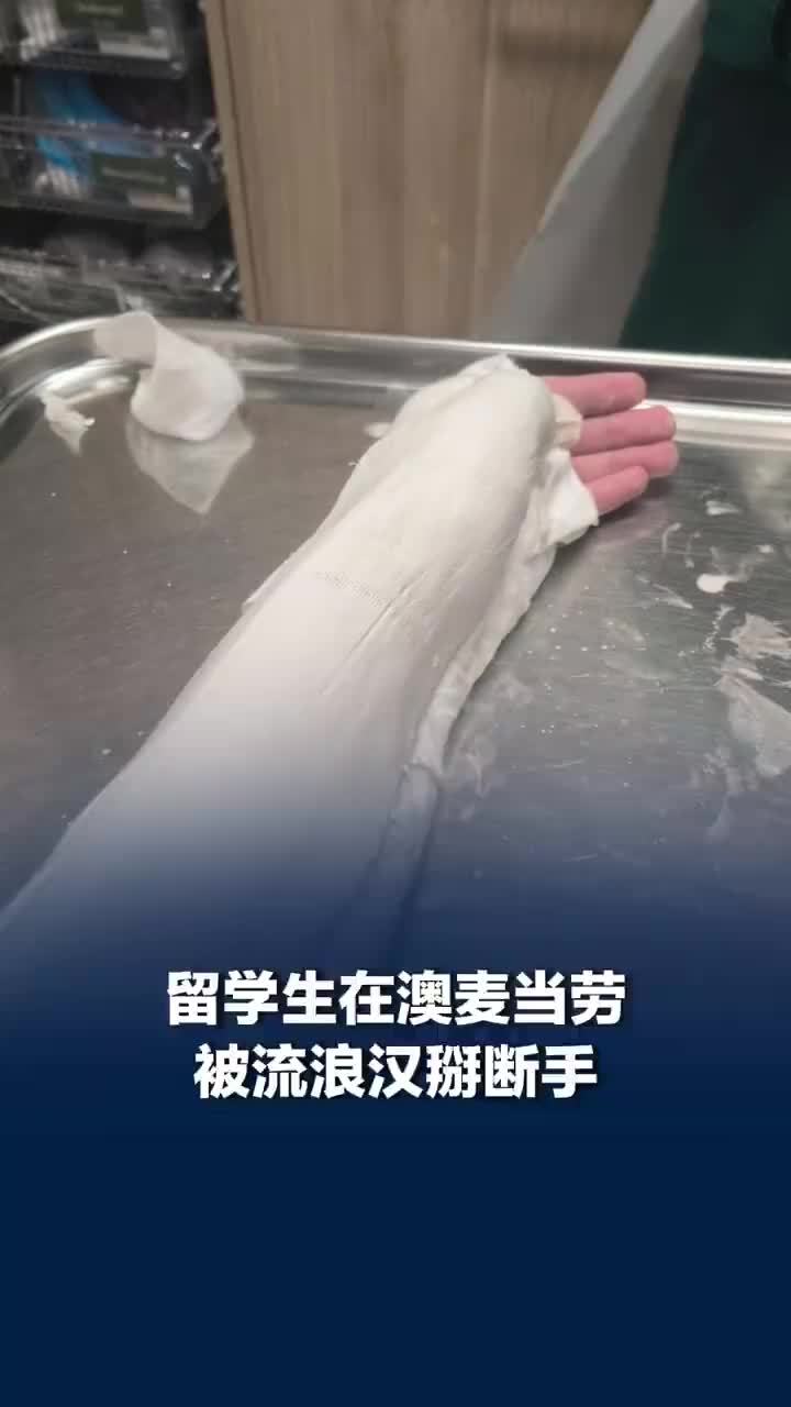 留学生在悉尼麦当劳被流浪汉掰断手，留学生回应在悉尼被流浪汉掰断手：警方说可能会起诉他，治疗费用暂时免费