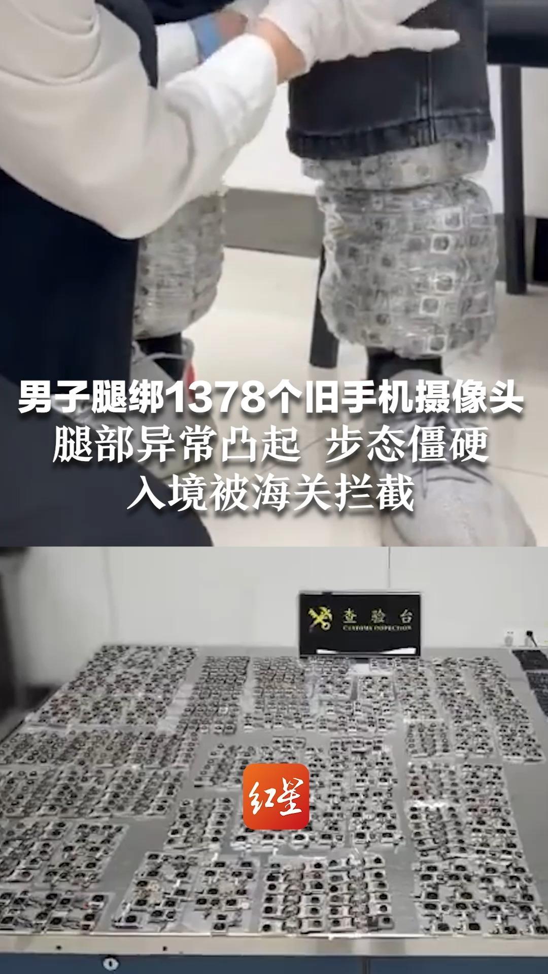 看着腿都麻了！男子腿绑1378个旧手机摄像头 腿部异常凸起 步态僵硬 入境被海关拦截