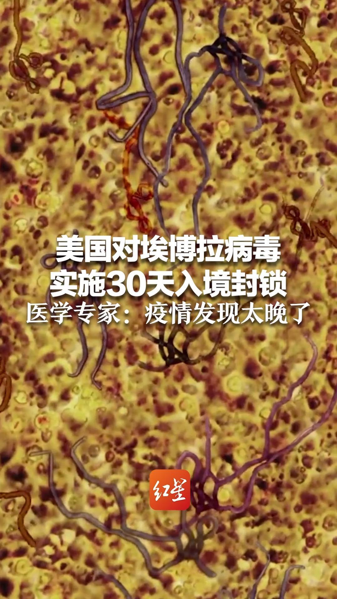 美国对埃博拉病毒实施30天入境封锁 医学专家：疫情发现太晚了 无特效药，死亡率高达40% 感染规模可能远高于目前数据