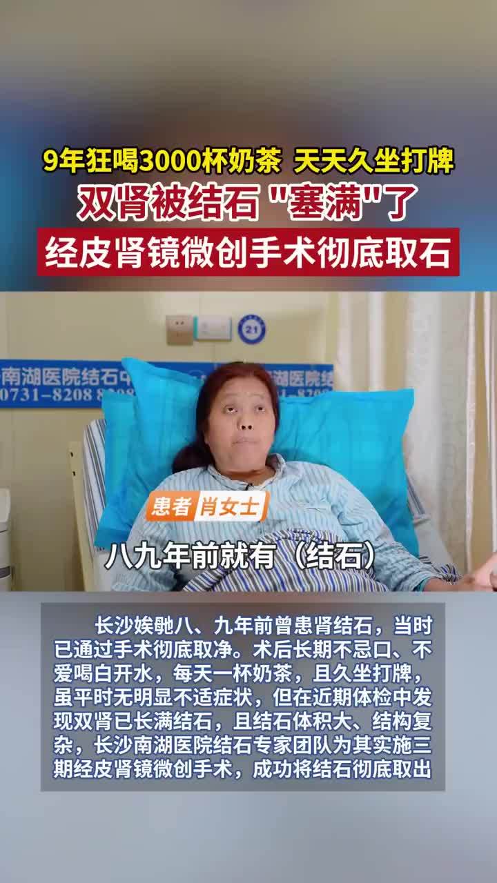 女子9年喝3千杯奶茶双肾长满结石