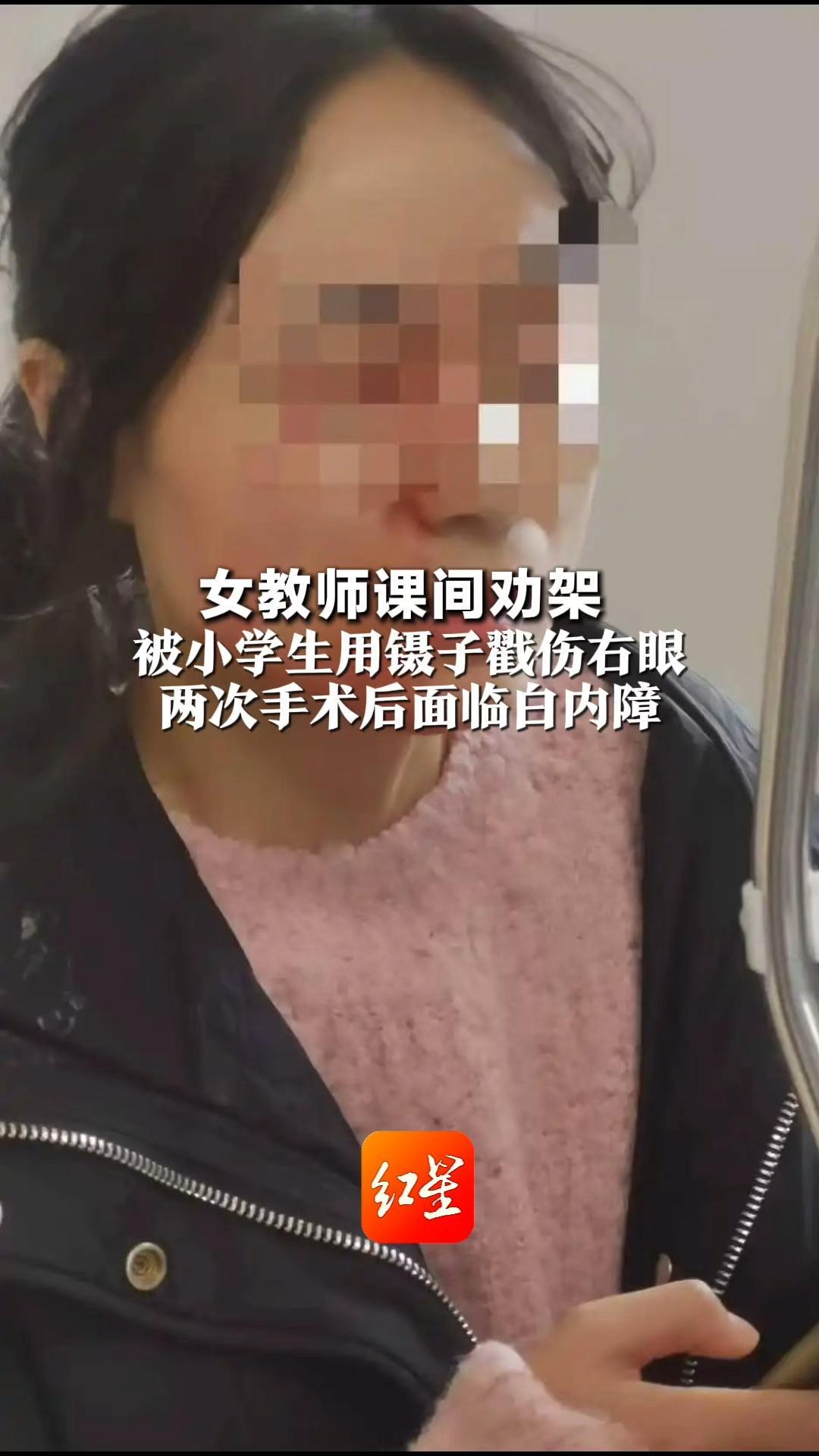 女教师课间劝架 被小学生用镊子戳伤右眼 两次手术后面临白内障 学生未满14岁免于处罚 ，老师申请复议