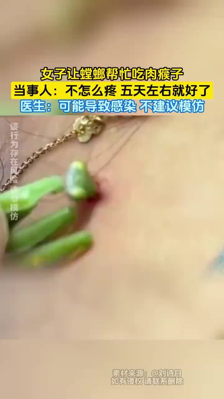女子让螳螂帮忙吃掉肉瘊子