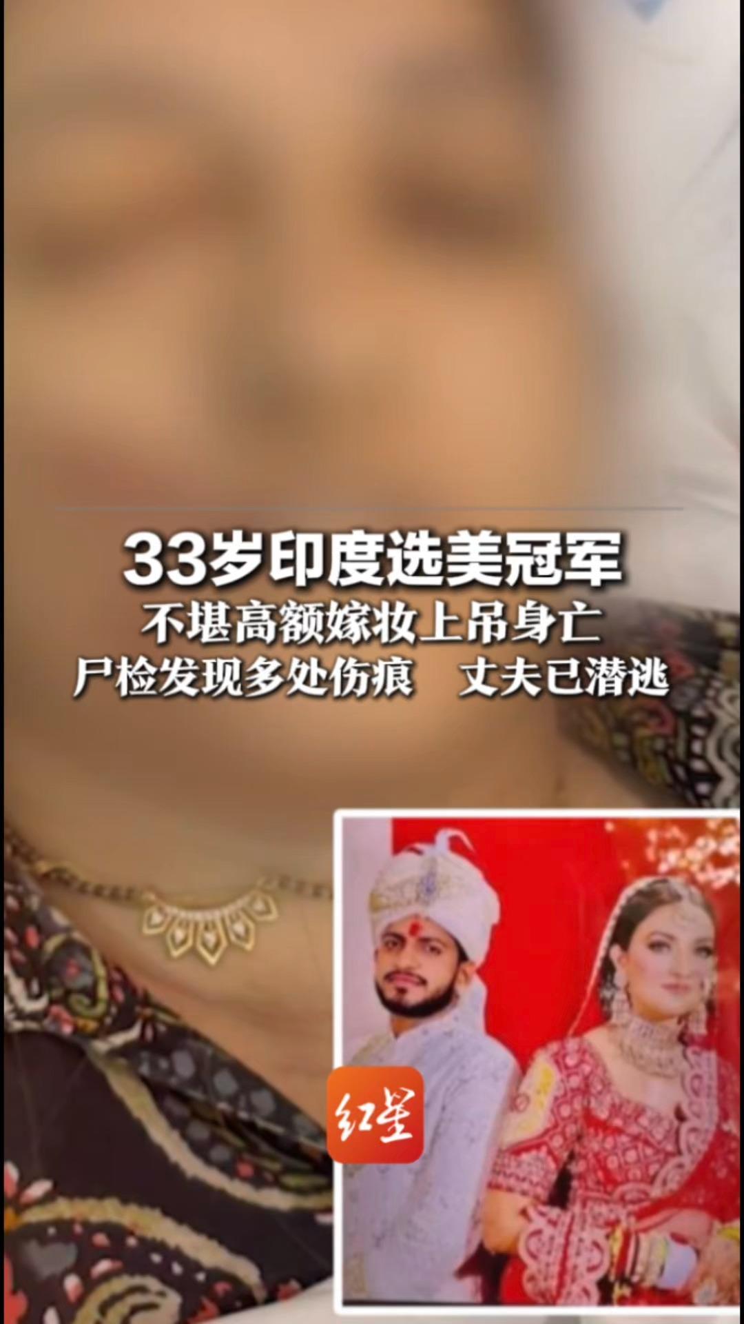 陪嫁140万人民币仍遭虐待？33岁印度选美冠军 不堪高额嫁妆上吊身亡 尸检发现多处伤痕  丈夫已潜逃