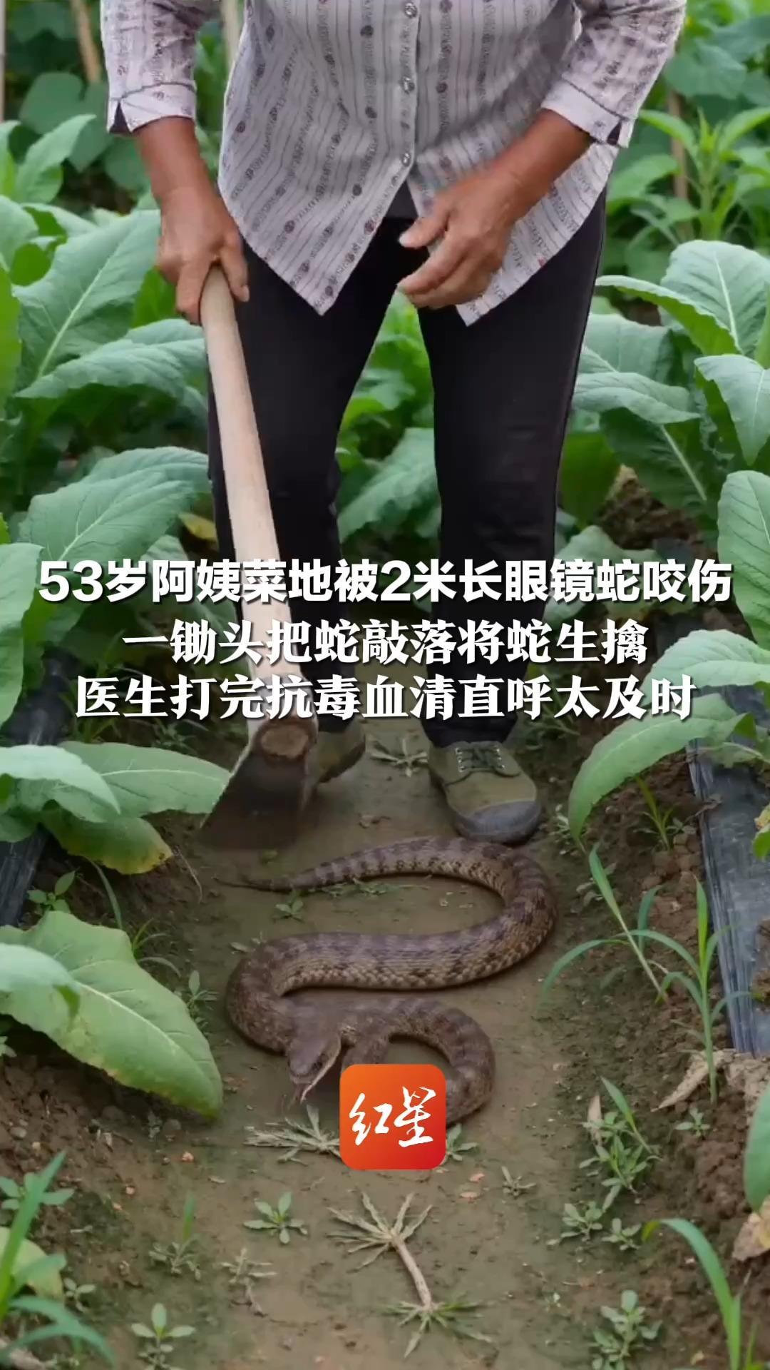 53岁阿姨菜地被2米长眼镜蛇咬伤 一锄头把蛇敲落将蛇生擒 带蛇去医院确认种类 医生打完抗毒血清直呼太及时