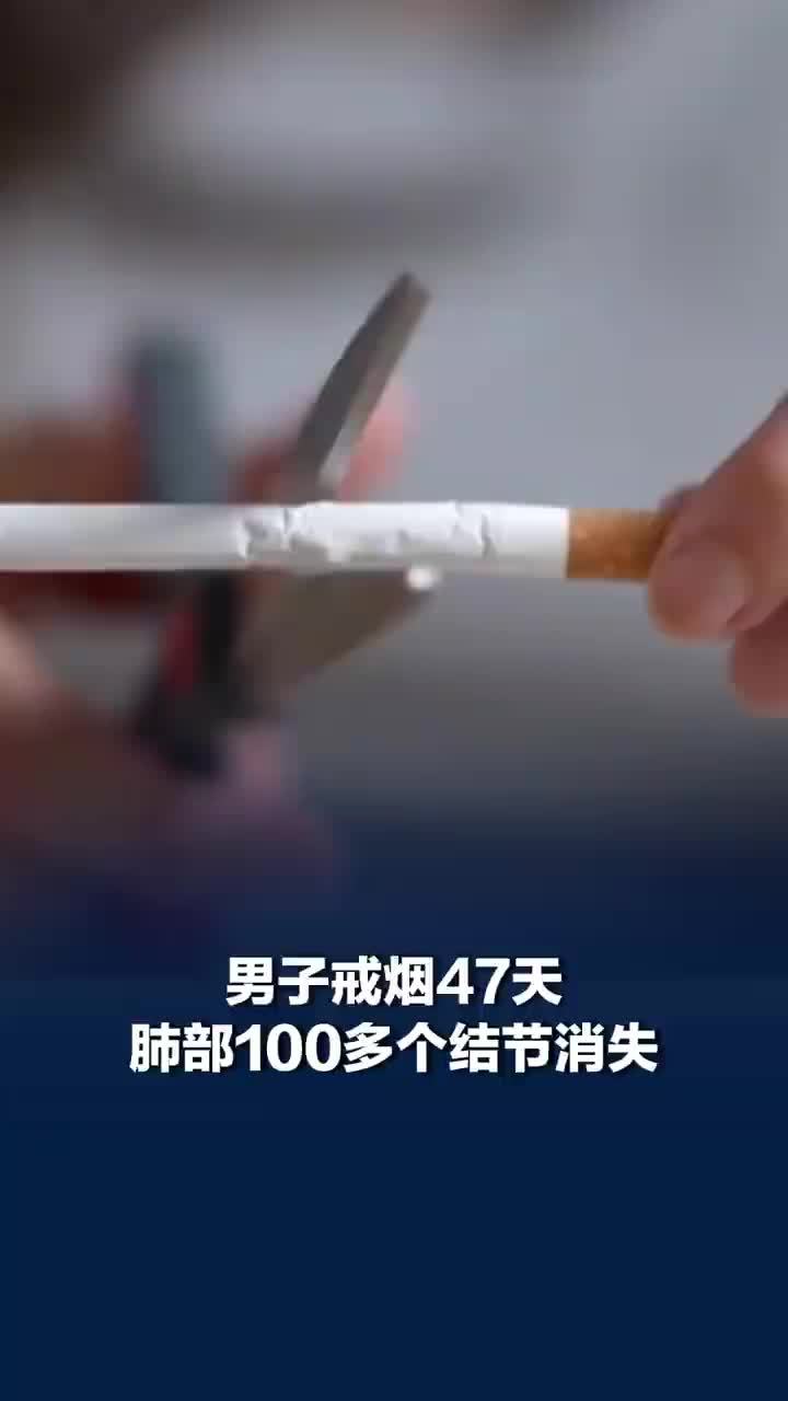 男子戒烟47天肺部100多个结节消失
