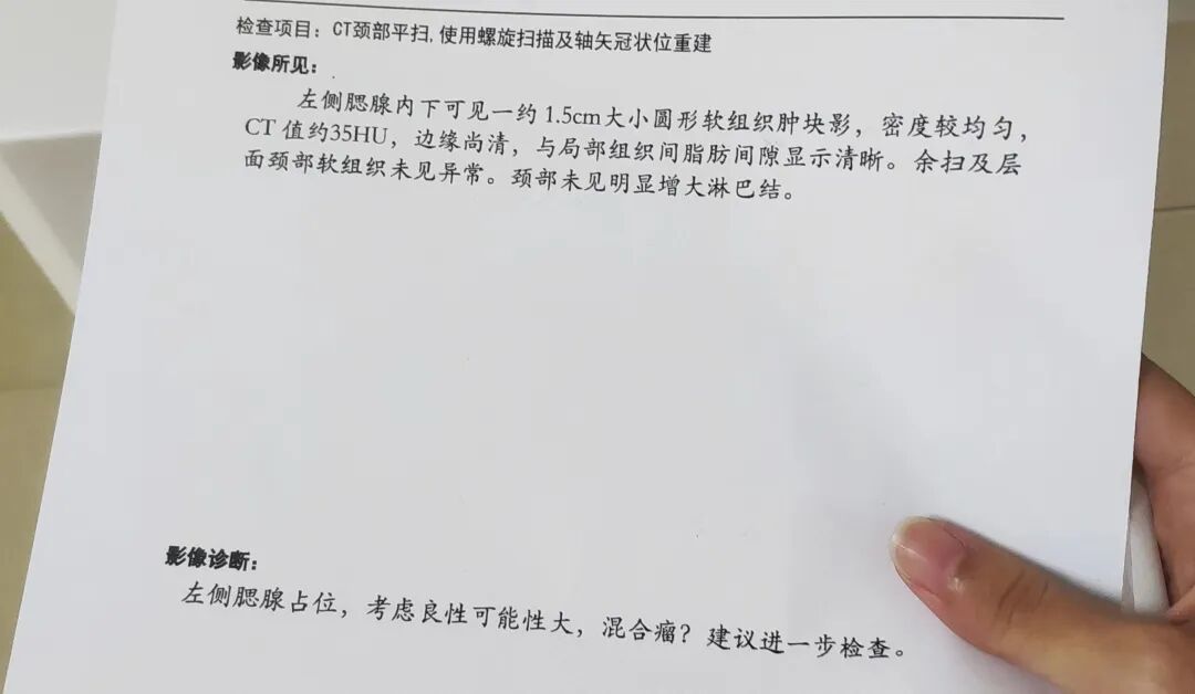 头颈部CT显示左侧腮腺占位,混合瘤可能。丨作者供图