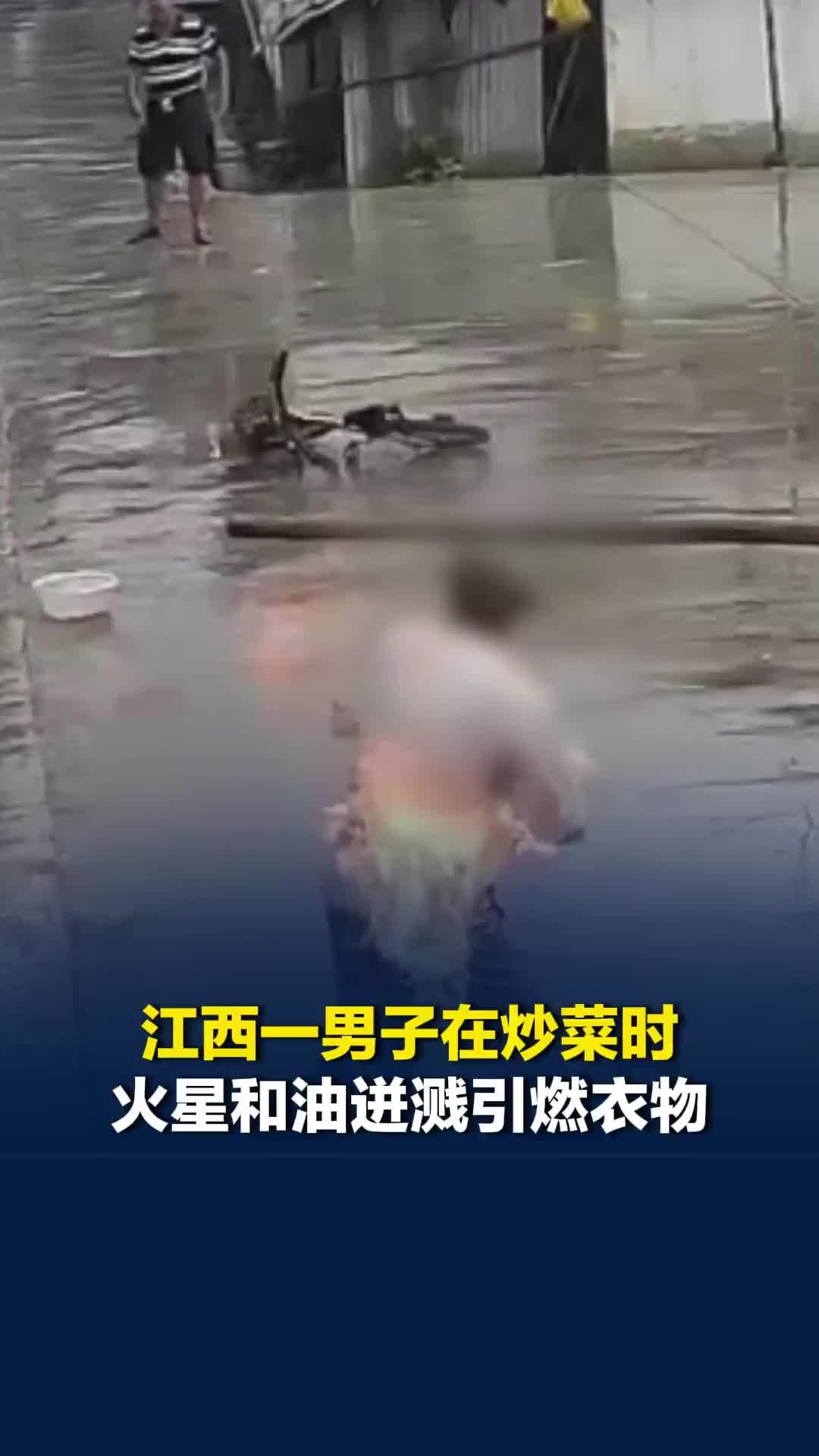 江西一男子在炒菜时，火星和油迸溅引燃衣物，儿子回应：父亲双手、胸部均被烧伤