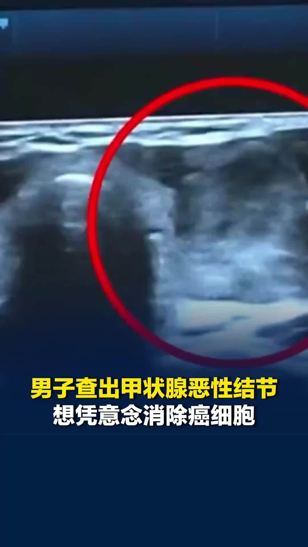 30岁男子查出甲状腺癌后竟问医生：“我能不能用意念杀死癌细胞”，医生提醒