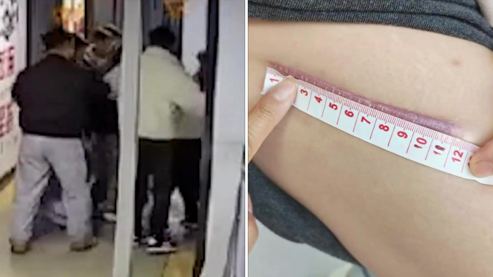 女子微信群辱骂他人被打成脑震荡，家属：她骂得难听，但也伤得较重