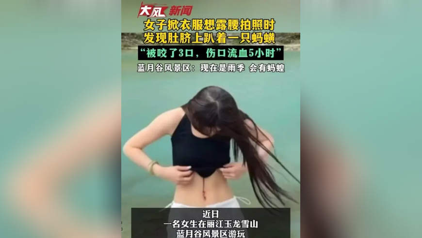 女子掀衣服想露腰拍照时 发现肚脐上趴着一只蚂蟥 “被咬了3口 伤口流血5小时” 蓝月谷风景区：现在是雨季 会有蚂蝗