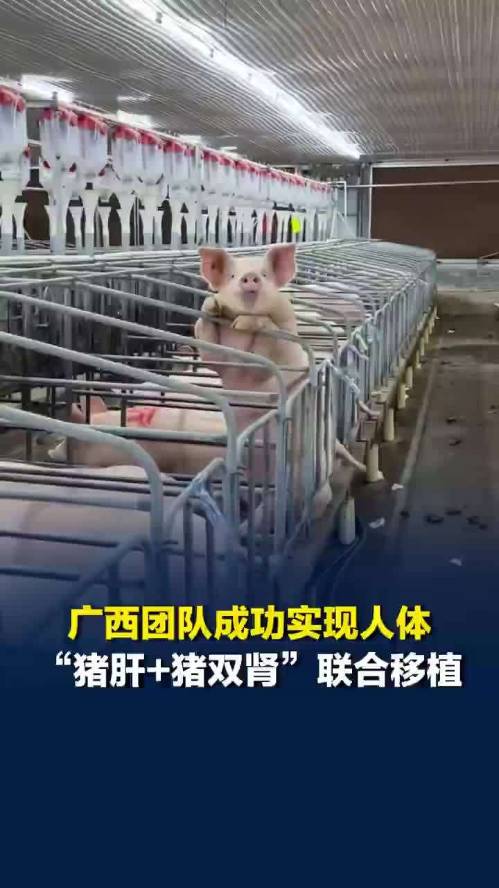 广西团队实现猪肝肾同期人体移植
