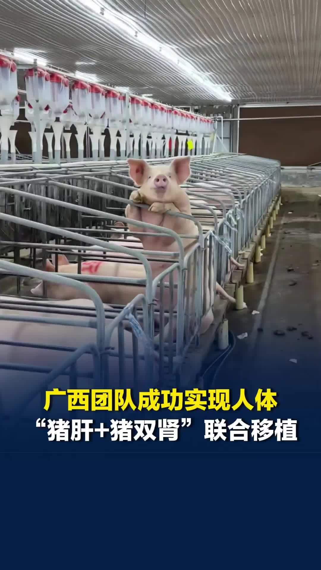 全球首例！广西团队成功实现人体“猪肝+猪双肾”联合移植