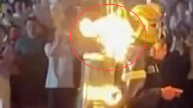演员进行喷火表演，衣服被引燃致灼伤脖子