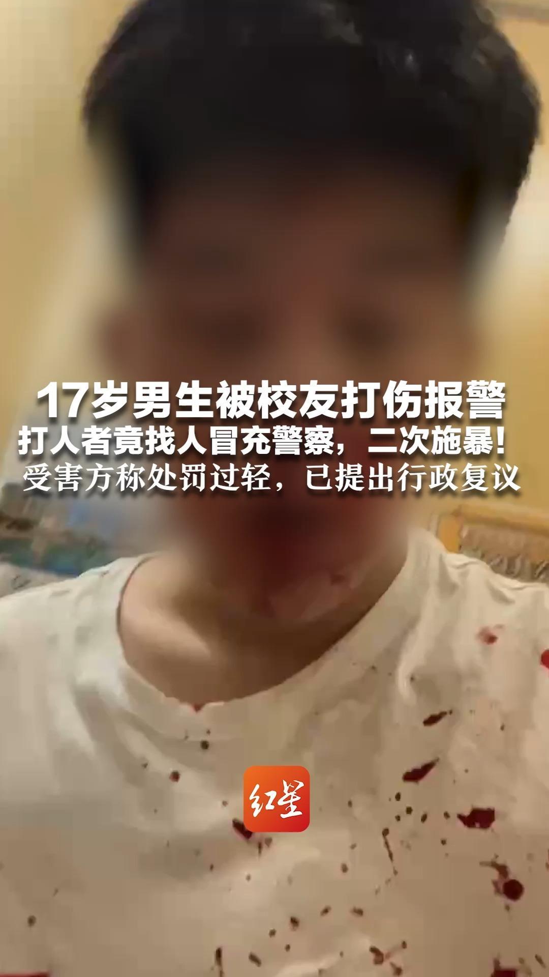 17岁男生被校友打伤报警 打人者竟找人冒充警察，二次施暴！受害方称处罚过轻，已提出行政复议 对方家属称是“小孩打架”