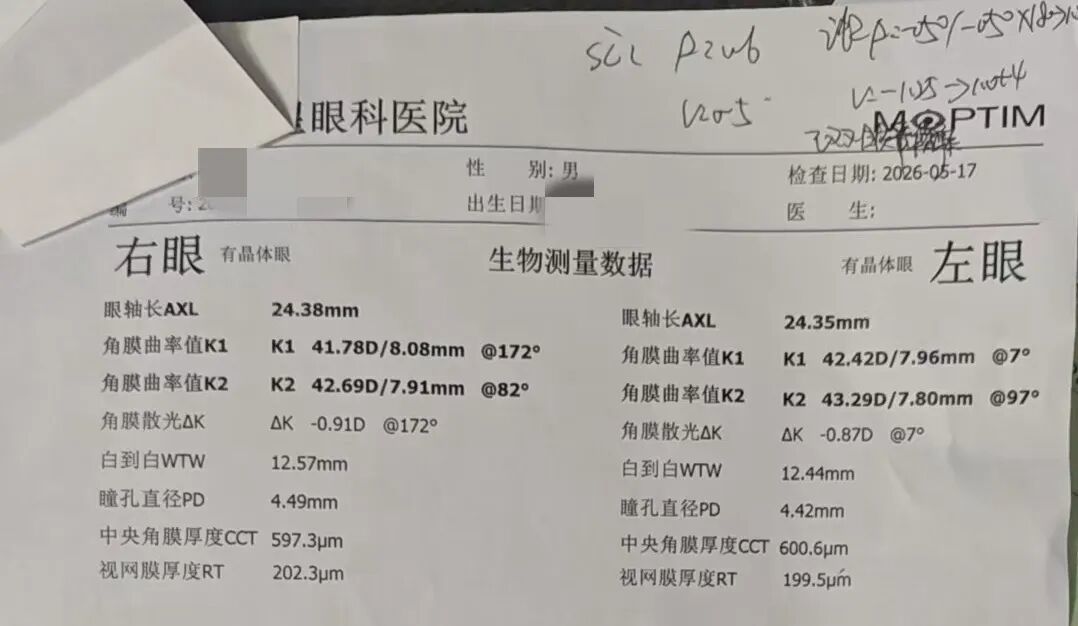5.17检测的眼轴长，右眼眼轴长增至24.38mm，左眼眼轴长增至24.35mm