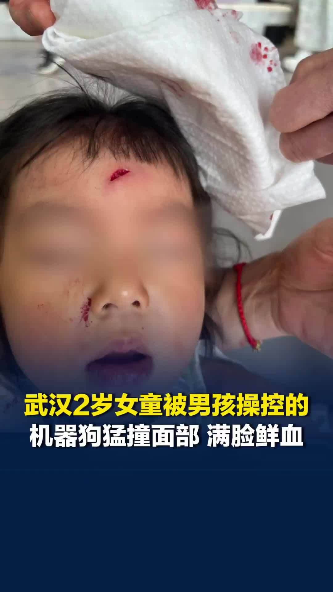 武汉2岁女童被一男孩操控的机器狗猛撞面部，门店回应：确有此事