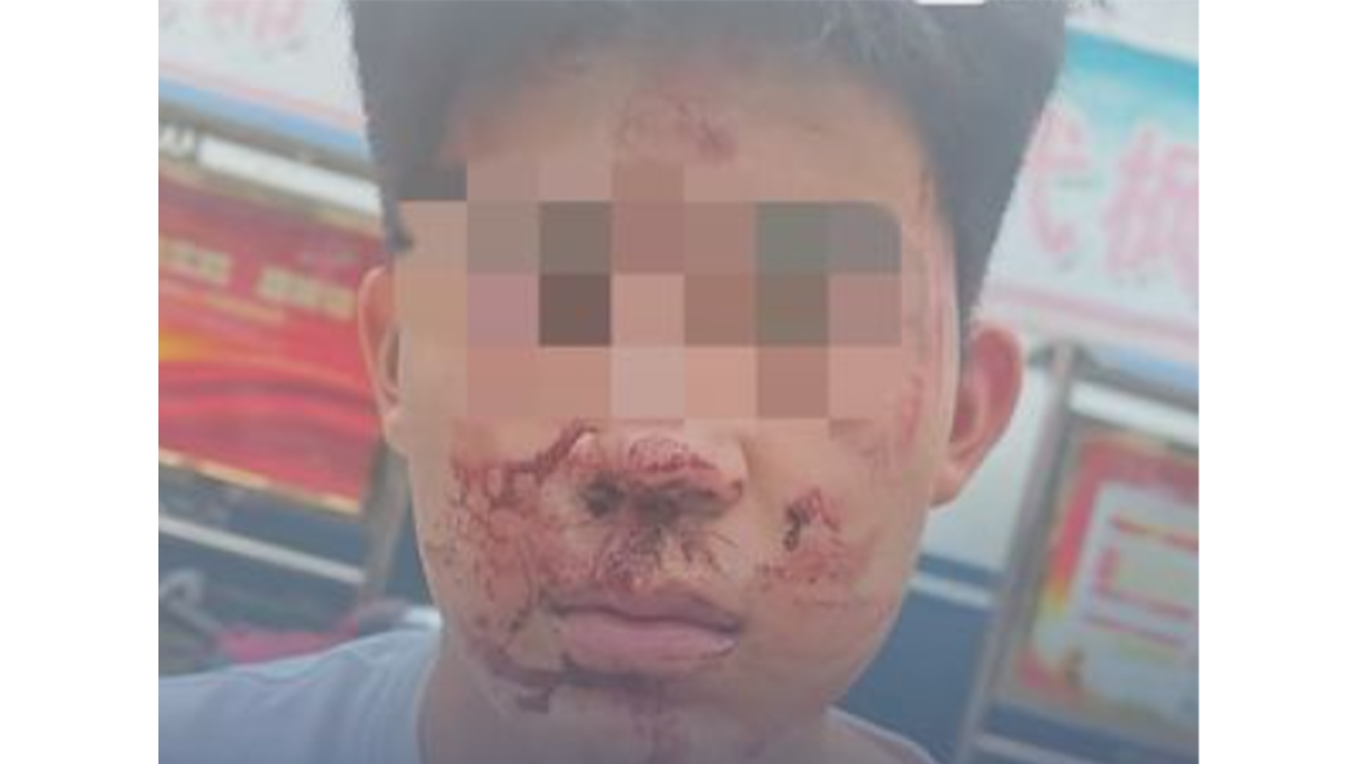 太恶劣！17岁男生被校友打伤后报警，打人者竟找人冒充警察二次施暴！打人者被拘12天，冒充警察者被拘7天，受害方认为处罚过轻
