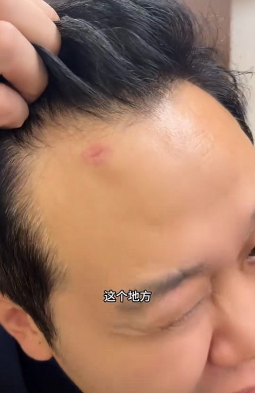 王先生额头