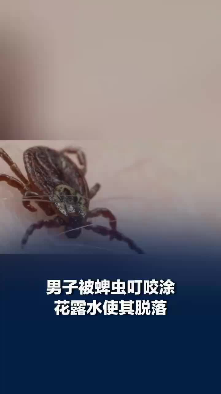 男子被蜱虫叮咬涂花露水使其脱落