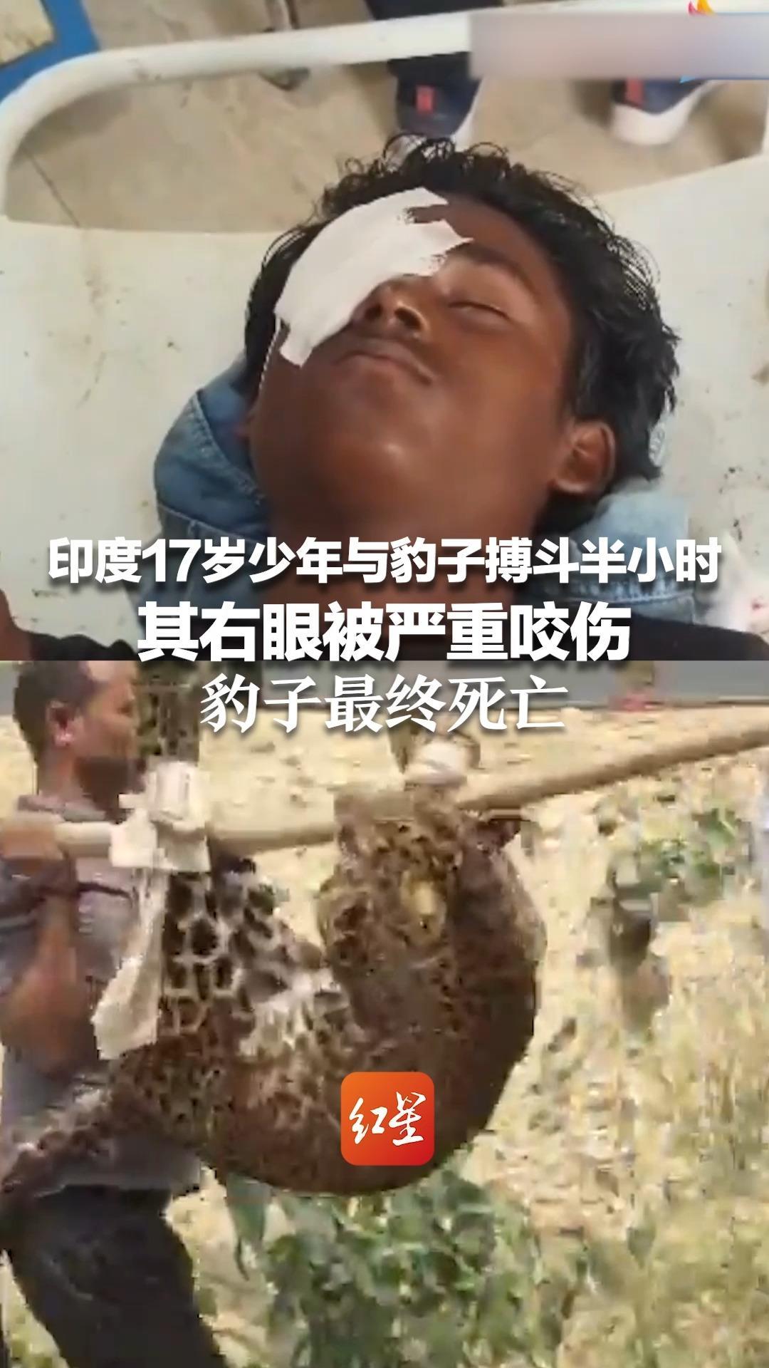 印度版武松！印度17岁少年与豹子搏斗半小时 其右眼被严重咬伤 豹子最终死亡