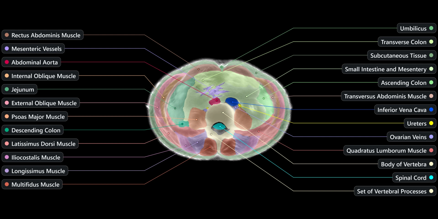 AI公司Midjourney跨界发布首款硬件“全身超声波扫描仪”:60秒生成3D人体图,前苹果Vision Pro工程师带队