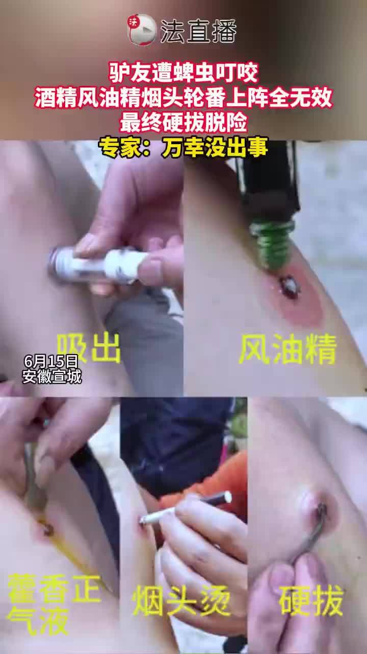 用酒精烟头驱蜱虫无效驴友硬拔