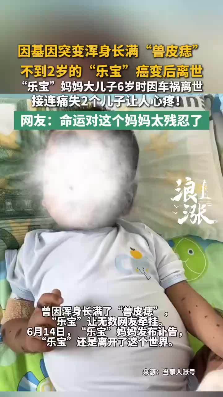 兽皮痣患儿乐宝离世年仅2岁