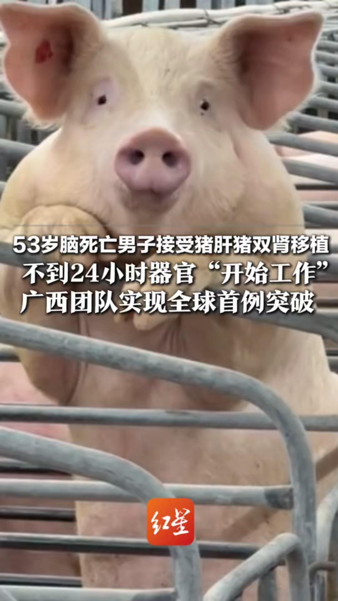 53岁脑死亡男子接受猪肝猪双肾移植 不到24小时器官“开始工作”广西团队实现全球首例 人体“猪肝+猪双肾”联合移植