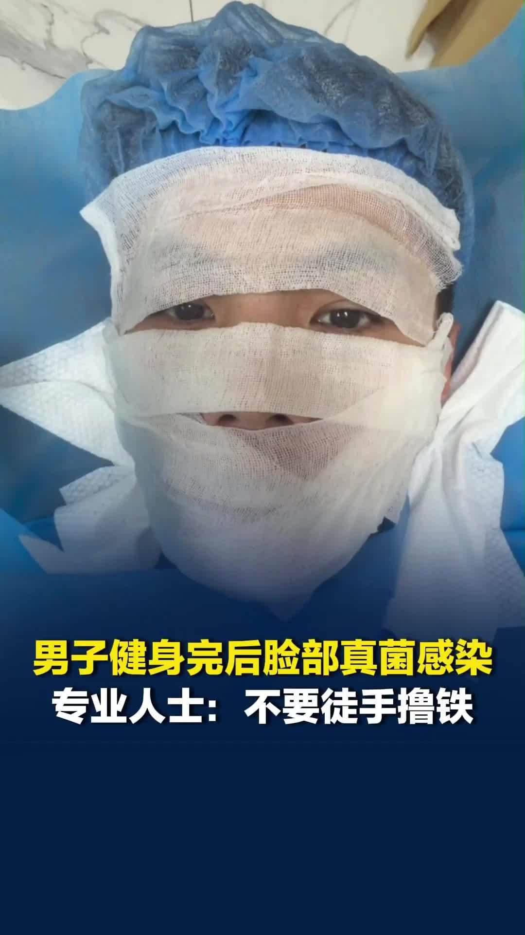 男子健身完后脸部真菌感染，不少网友分享自己的“中招史”，专业人士：不要徒手撸铁