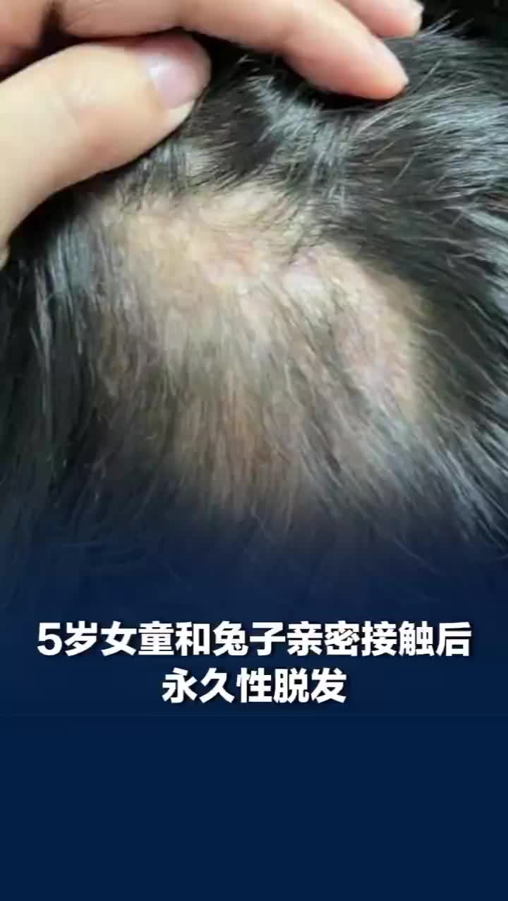 5岁女孩摸邻居家兔子头顶长脓包