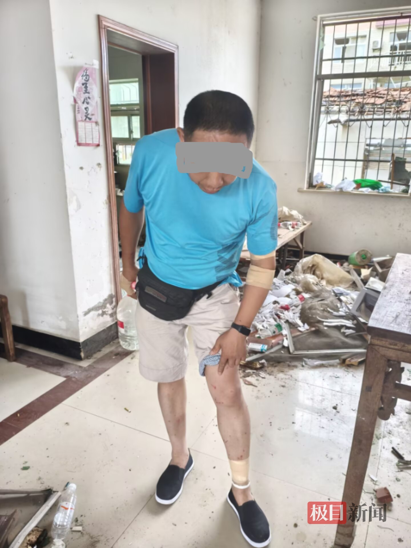 曹炎桥身体多处被玻璃碎片划伤