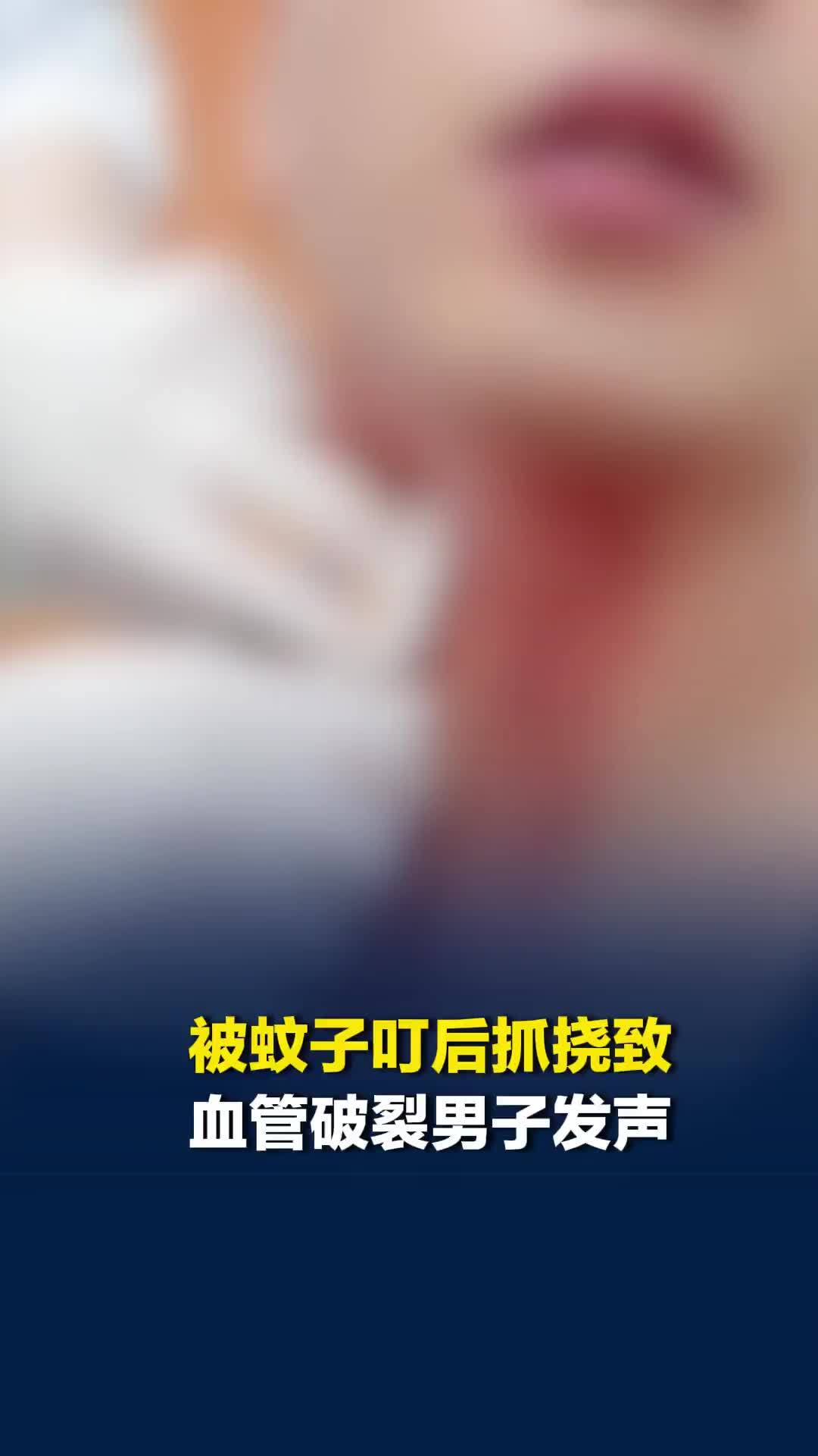 被蚊子叮后抓挠致血管破裂男子发声：以后看到蚊子都会躲着走