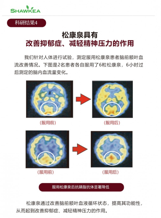 第六届湖南省辅助生殖质控研讨会召开，Shawkea松康泉等产品成现场焦点