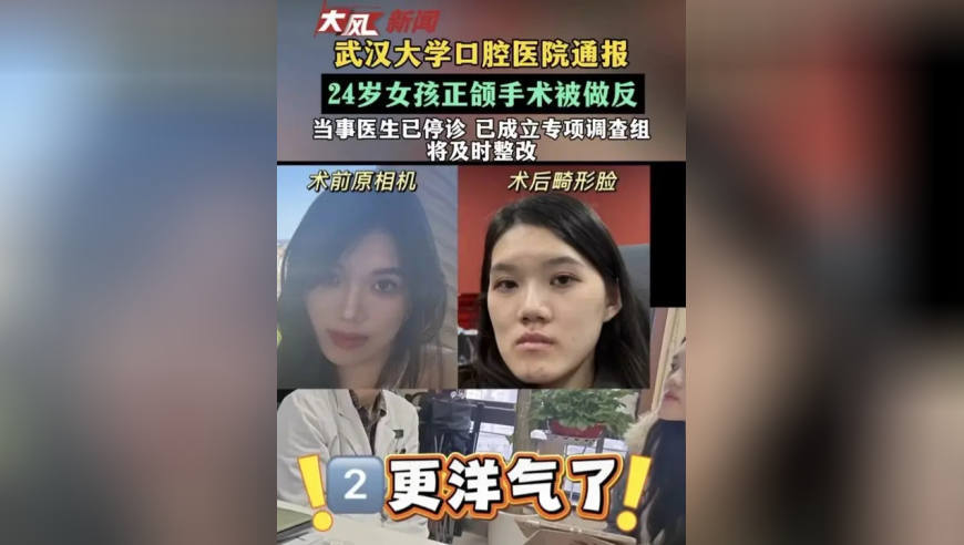 武汉大学口腔医院通报 24岁女孩正颌手术被做反 当事医生已停诊 已成立专项调查组 将及时整改