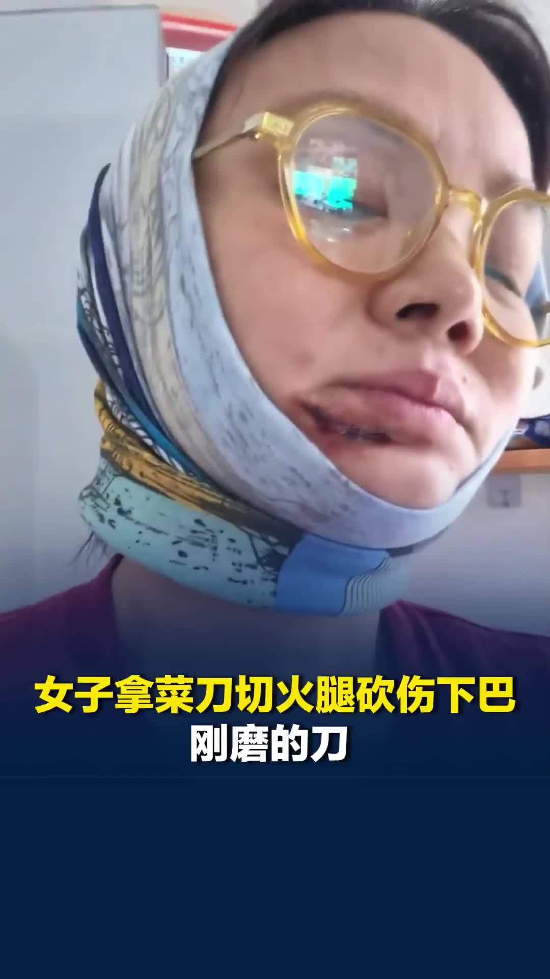 北京一女子拿菜刀切火腿砍伤下巴：刚磨的刀，千防万防，怎么也没想到会剁到脸上