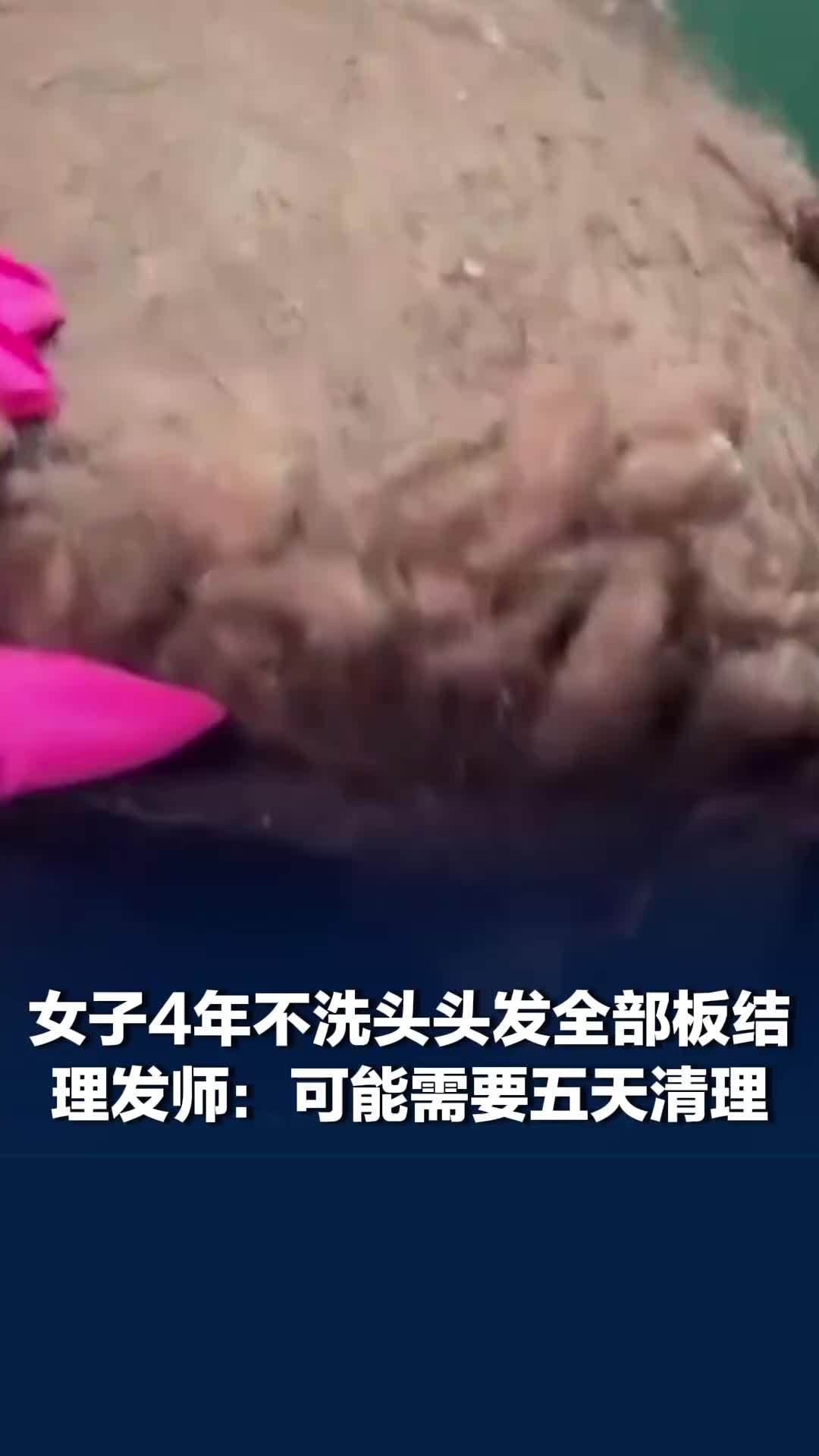 女子4年不洗头头发全部板结，理发师：可能需要五天清理