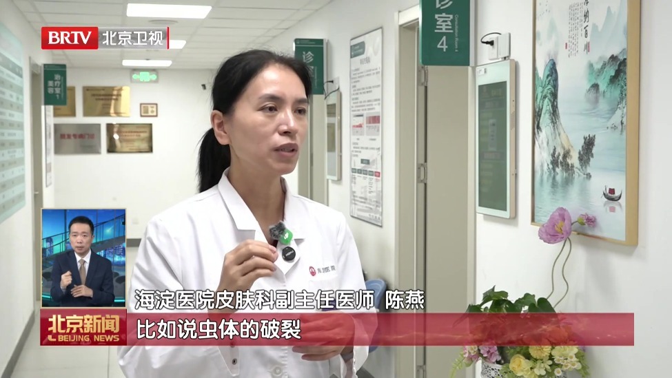 隐翅虫进入高发活跃期 不要徒手拍打隐翅虫